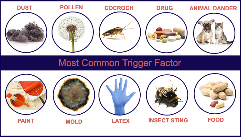 Most Common Trigger Factor